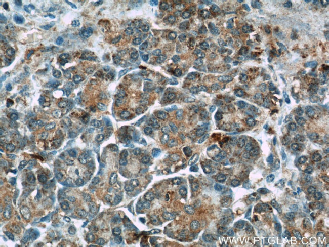THADA Antibody in Immunohistochemistry (Paraffin) (IHC (P))
