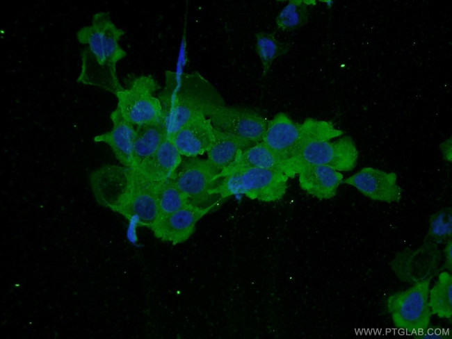 PLS3 Antibody in Immunocytochemistry (ICC/IF)