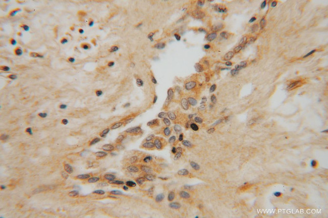 NME5 Antibody in Immunohistochemistry (Paraffin) (IHC (P))
