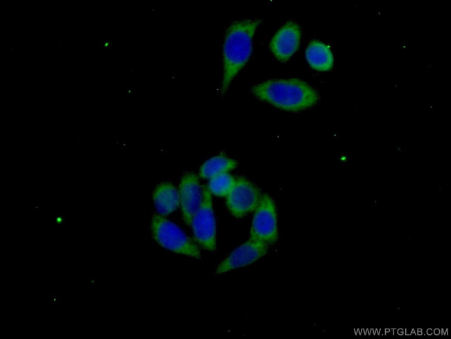 IRF6 Antibody in Immunocytochemistry (ICC/IF)