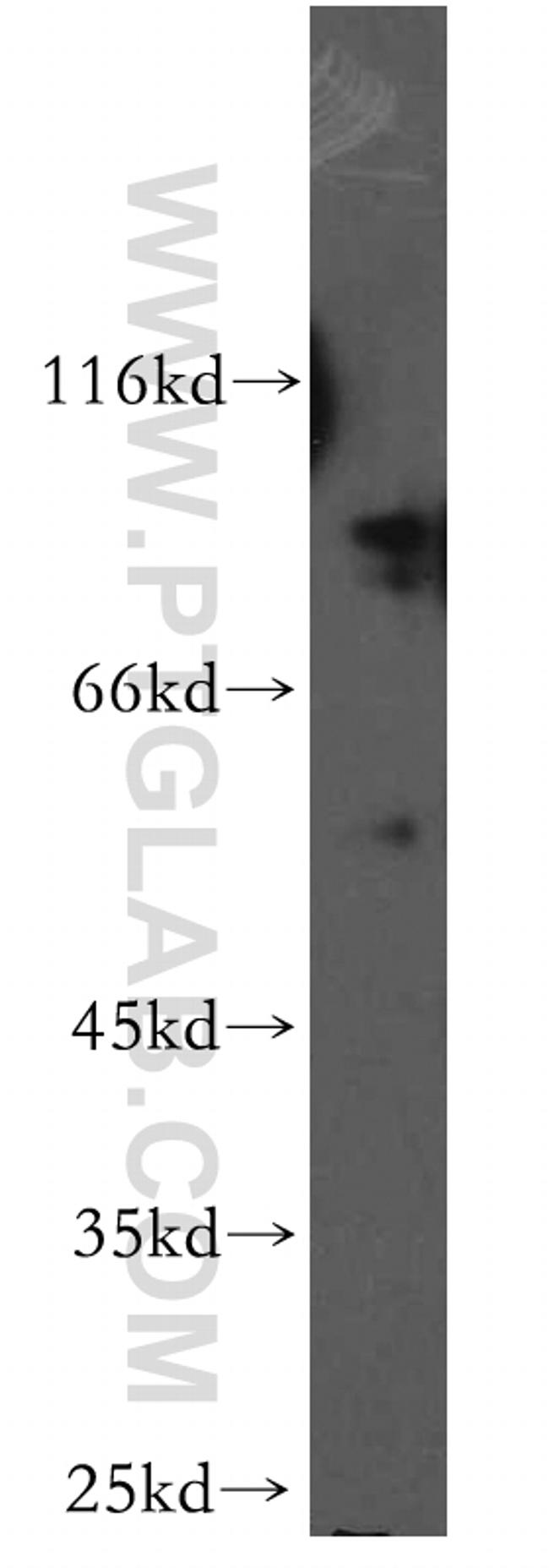 MARK3 Antibody in Western Blot (WB)