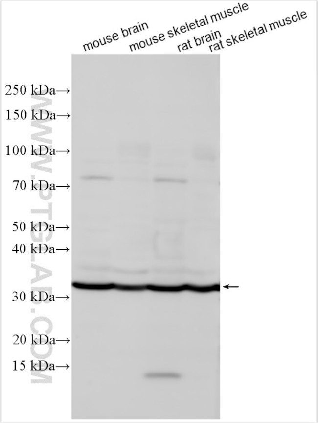 KCNMB1 Antibody in Western Blot (WB)