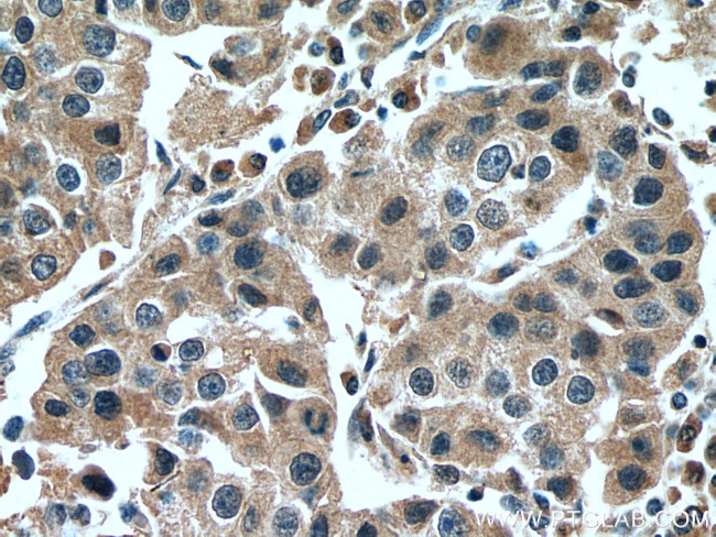 NFE2L1 Antibody in Immunohistochemistry (Paraffin) (IHC (P))