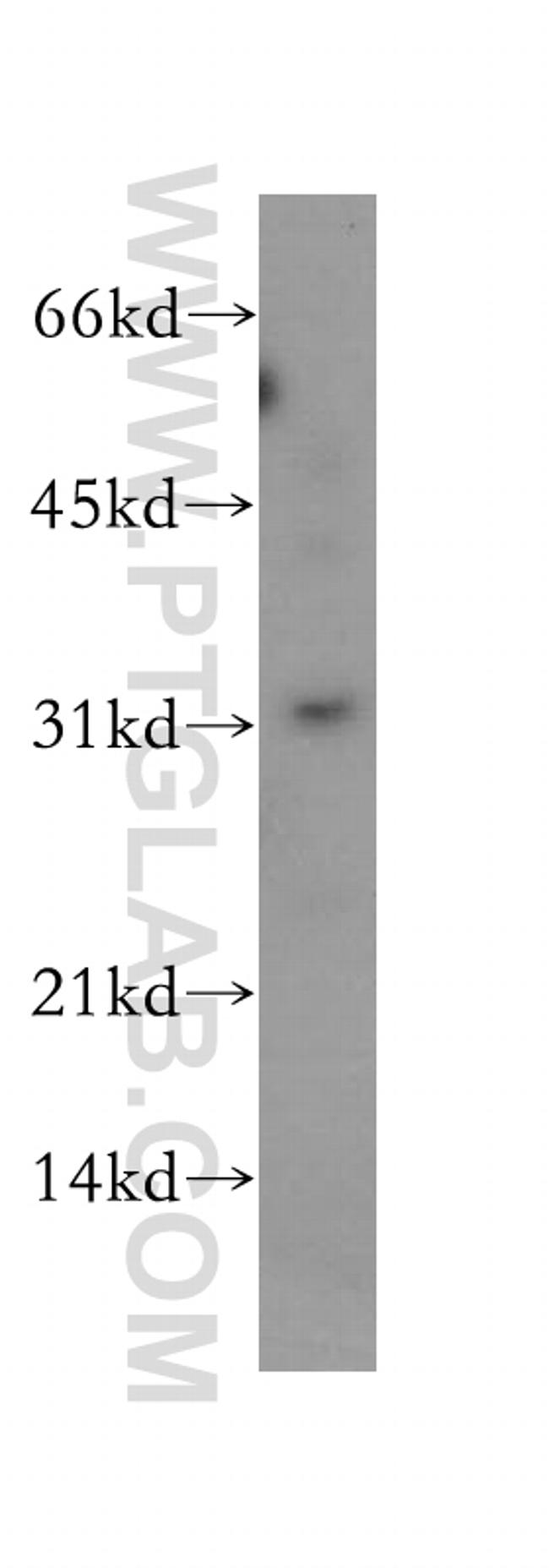 PSMF1 Antibody in Western Blot (WB)