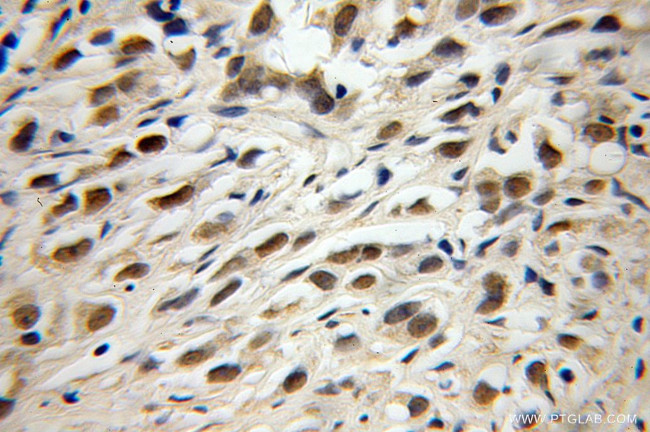 TRIM69 Antibody in Immunohistochemistry (Paraffin) (IHC (P))