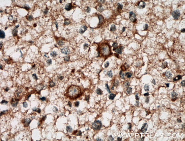 CA10 Antibody in Immunohistochemistry (Paraffin) (IHC (P))