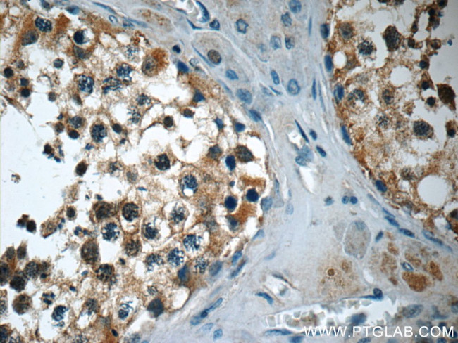 TEKT3 Antibody in Immunohistochemistry (Paraffin) (IHC (P))