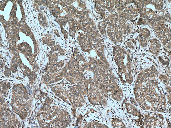 PPM1A Antibody in Immunohistochemistry (Paraffin) (IHC (P))