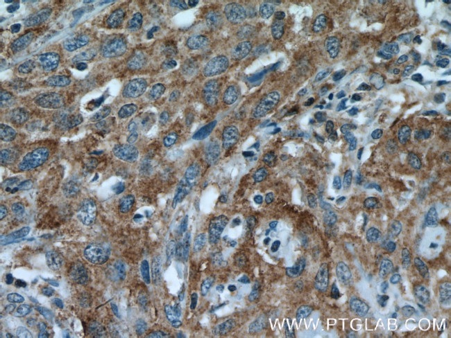 EBP Antibody in Immunohistochemistry (Paraffin) (IHC (P))