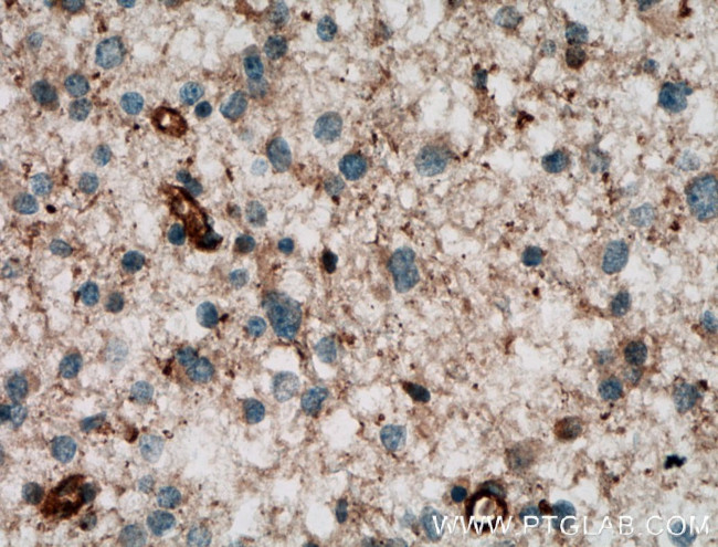 CPT1C Antibody in Immunohistochemistry (Paraffin) (IHC (P))