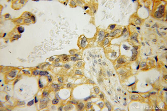 MPP7 Antibody in Immunohistochemistry (Paraffin) (IHC (P))