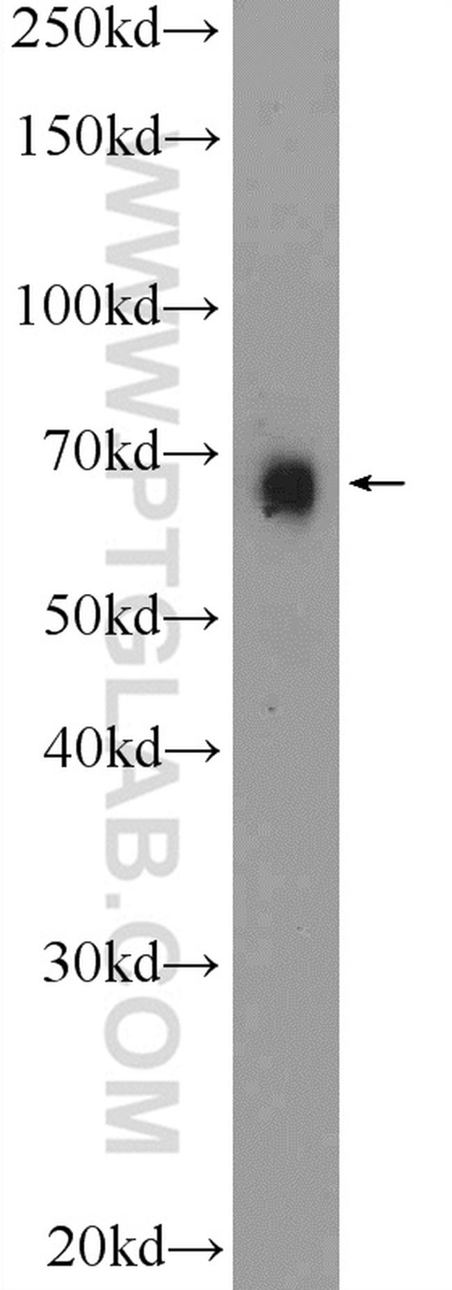 BNIP3L Antibody in Western Blot (WB)