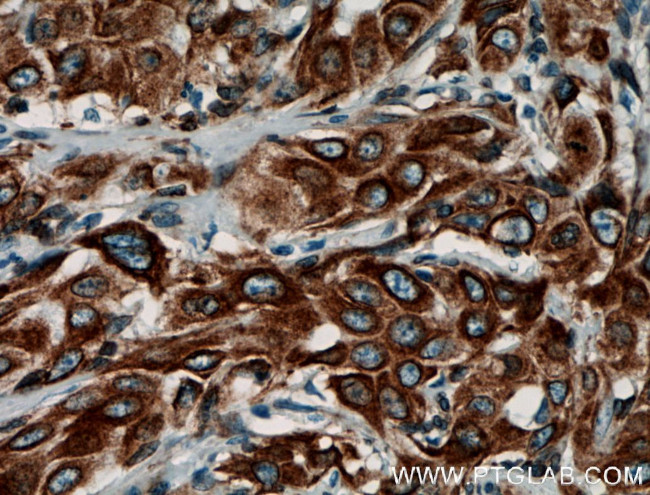 PGRMC1 Antibody in Immunohistochemistry (Paraffin) (IHC (P))
