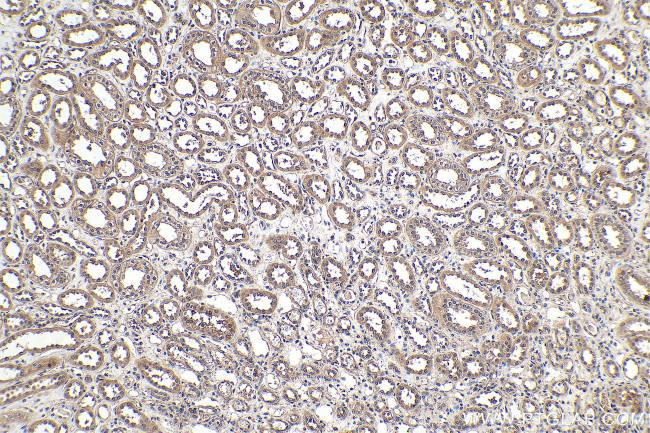 Ephrin B1 Antibody in Immunohistochemistry (Paraffin) (IHC (P))