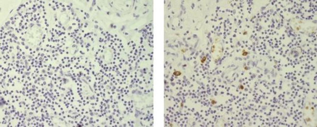 Rat IgG2b Secondary Antibody in Immunohistochemistry (Paraffin) (IHC (P))