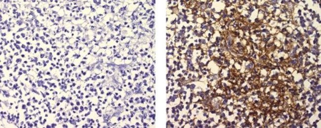 FDC Antibody in Immunohistochemistry (Paraffin) (IHC (P))