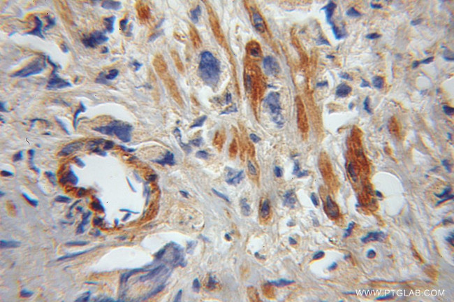 FAIM Antibody in Immunohistochemistry (Paraffin) (IHC (P))