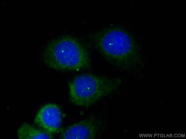 Ninein Antibody in Immunocytochemistry (ICC/IF)