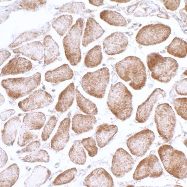 AMPK alpha 1 Antibody in Immunohistochemistry (IHC)