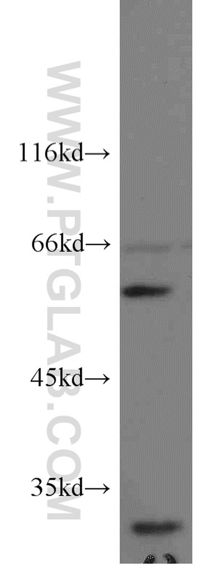 STAM2 Antibody in Western Blot (WB)