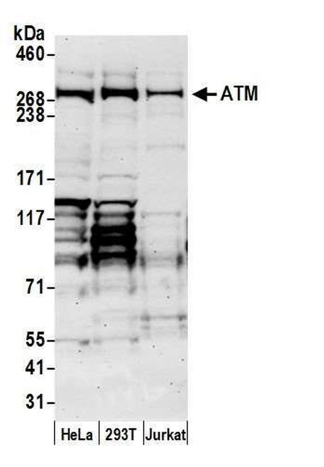 ATM Antibody in Western Blot (WB)