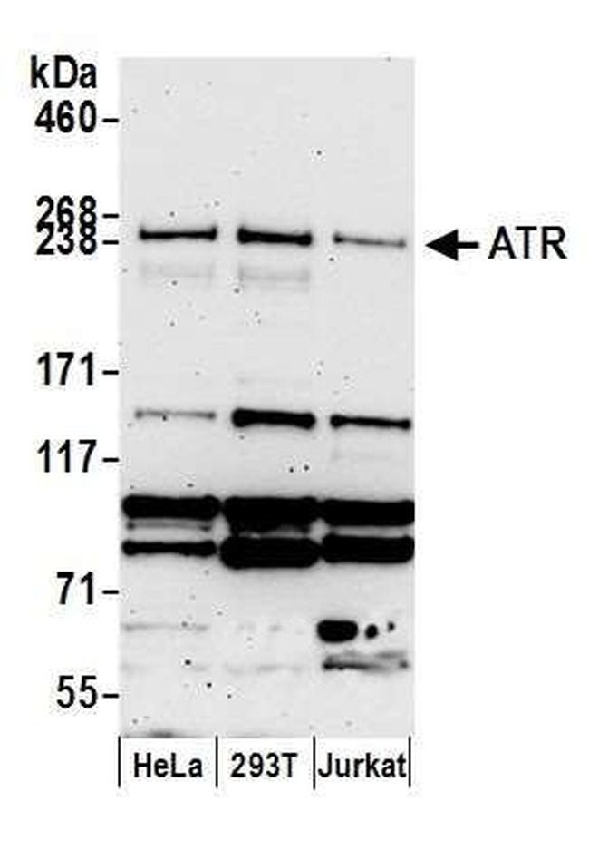 ATR Antibody in Western Blot (WB)