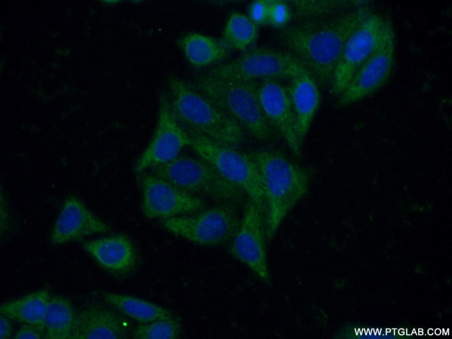MMP23B Antibody in Immunocytochemistry (ICC/IF)