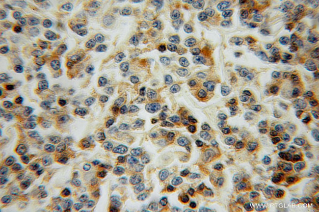 L-Plastin Antibody in Immunohistochemistry (Paraffin) (IHC (P))