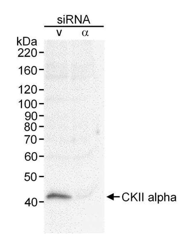CKII alpha Antibody in Western Blot (WB)