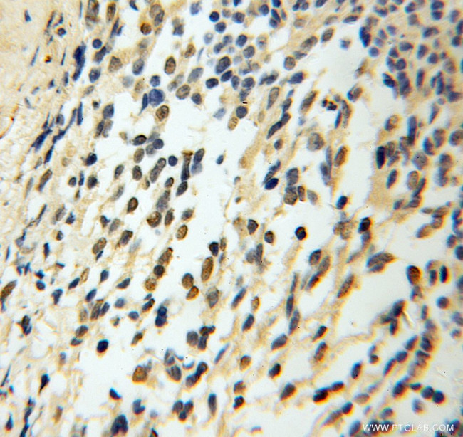 CHTF18 Antibody in Immunohistochemistry (Paraffin) (IHC (P))