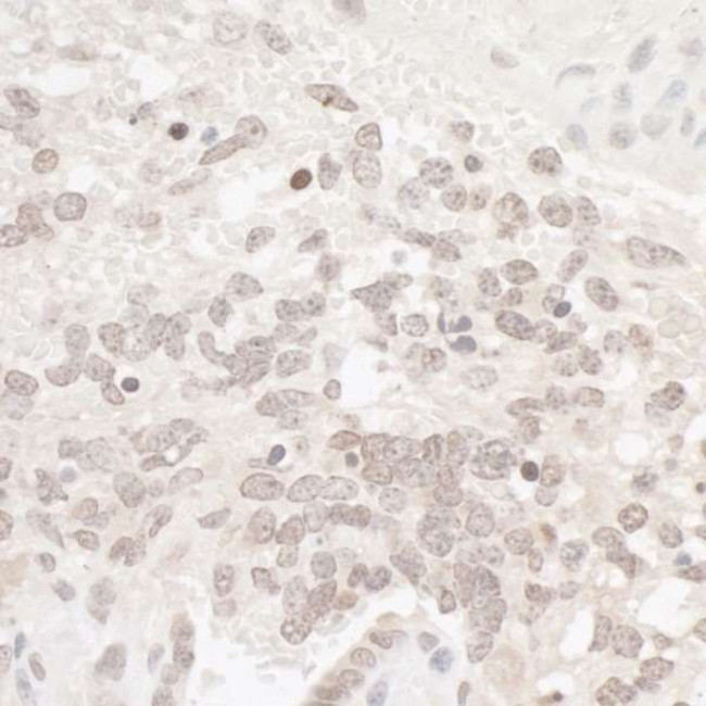 CKII alpha Antibody in Immunohistochemistry (IHC)