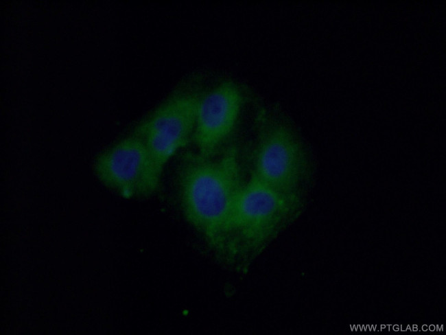 SACM1L Antibody in Immunocytochemistry (ICC/IF)