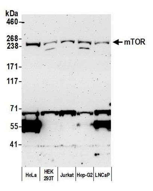 mTOR Antibody in Western Blot (WB)