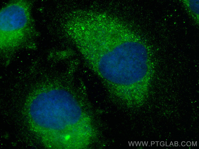 TSPAN3 Antibody in Immunocytochemistry (ICC/IF)