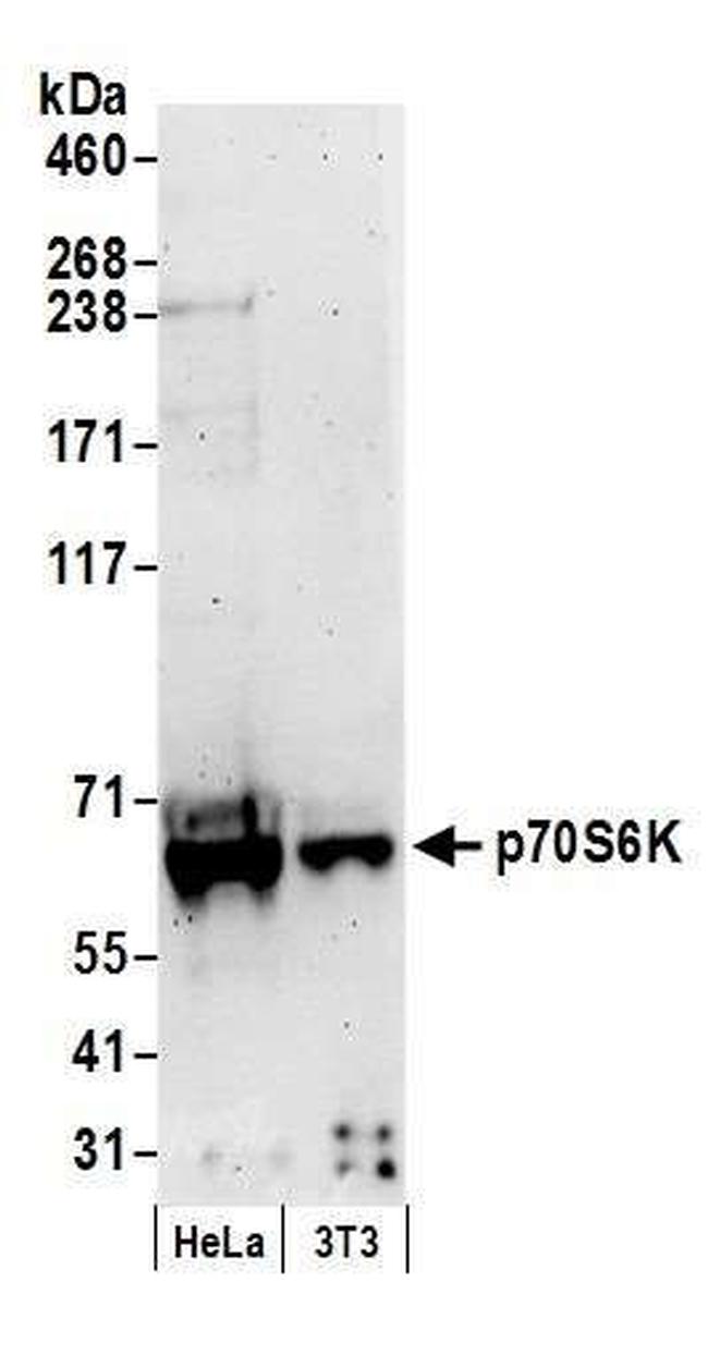 p70S6K Kinase Antibody in Western Blot (WB)