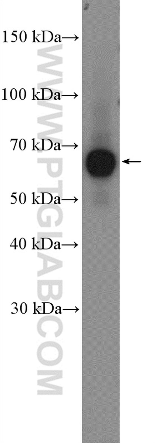 CACNB1 Antibody in Western Blot (WB)