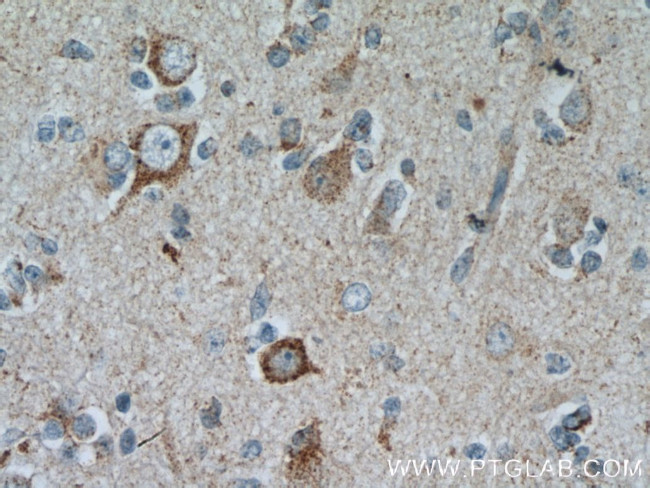 GRID1 Antibody in Immunohistochemistry (Paraffin) (IHC (P))