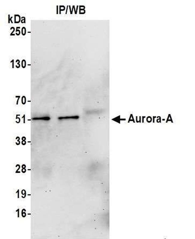 STK15 Antibody in Western Blot (WB)
