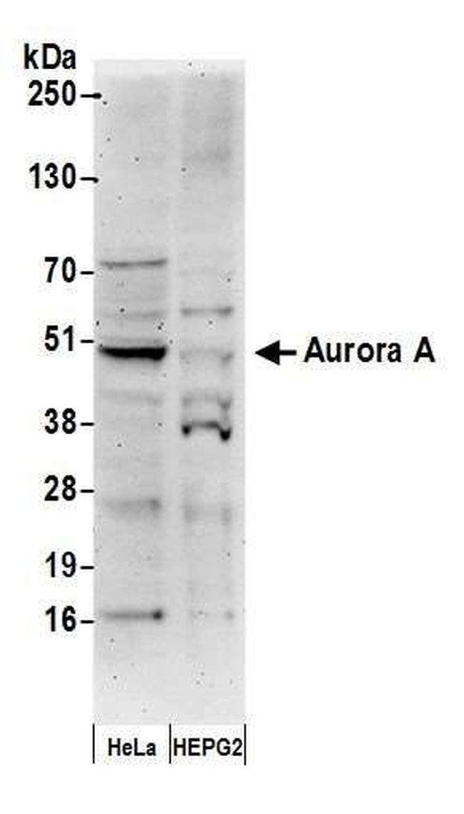 STK15 Antibody in Western Blot (WB)