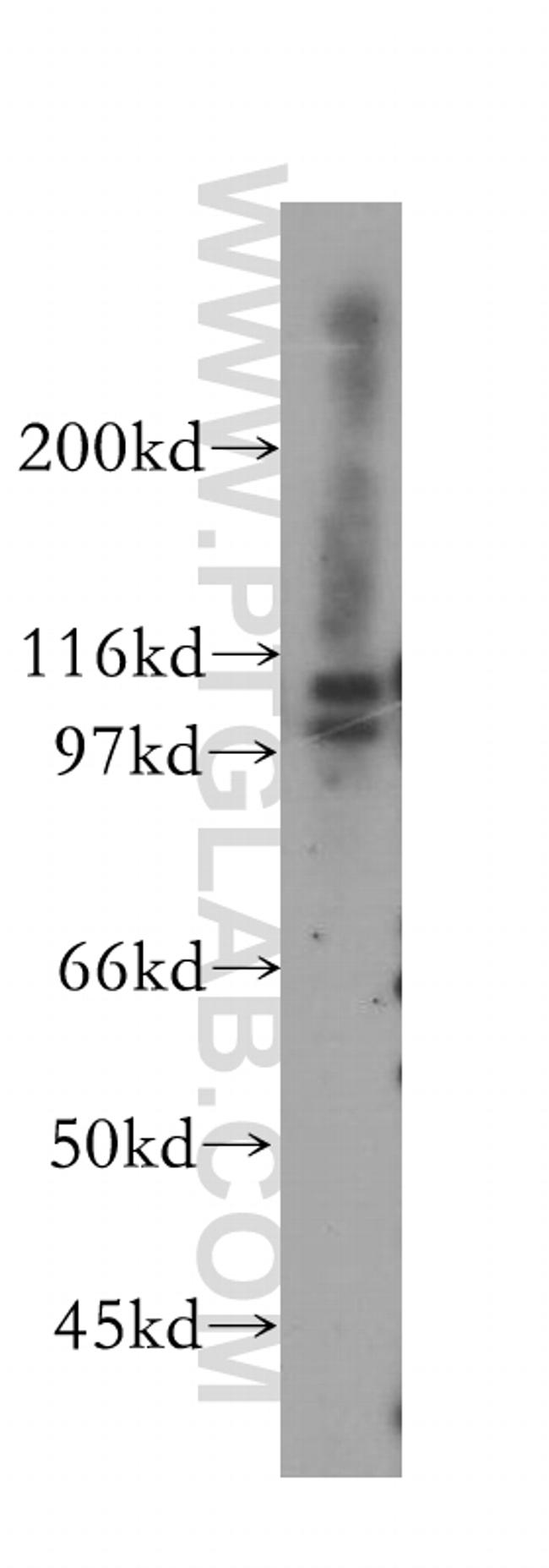 MCM4 Antibody in Western Blot (WB)