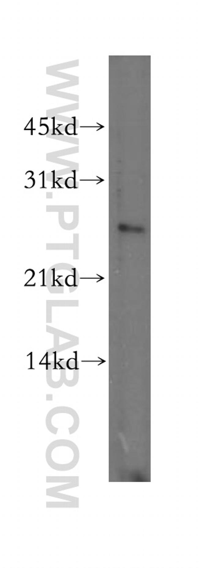 DLX1 Antibody in Western Blot (WB)