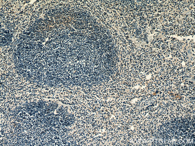 RAB37 Antibody in Immunohistochemistry (Paraffin) (IHC (P))