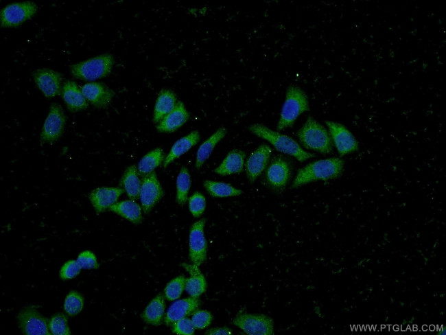 PFDN2 Antibody in Immunocytochemistry (ICC/IF)
