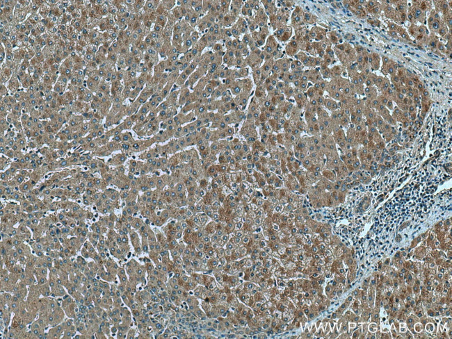 THRSP Antibody in Immunohistochemistry (Paraffin) (IHC (P))