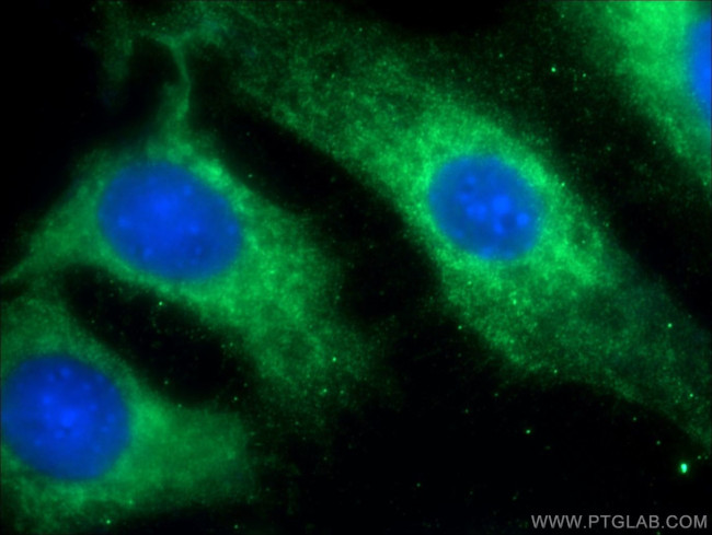 MACF1 Antibody in Immunocytochemistry (ICC/IF)