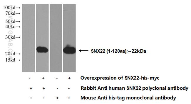 SNX22 Antibody in Western Blot (WB)
