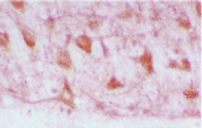 Heme oxygenase-2 (HO-2) Antibody in Immunohistochemistry (IHC)