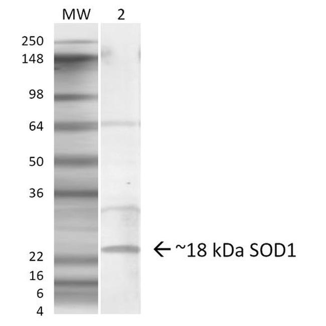 Superoxide dismutase 1 (SOD1) Antibody in Western Blot (WB)