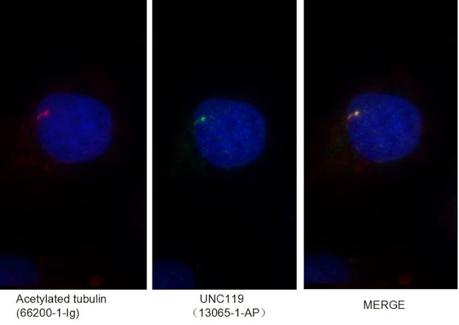 UNC119 Antibody in Immunocytochemistry (ICC/IF)