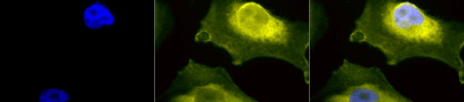 Superoxide dismutase 1 (SOD1) Antibody in Immunocytochemistry (ICC/IF)